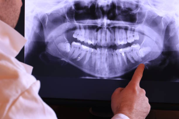 Best Chipped Tooth Repair Near Me  in Sherrelwood, CO